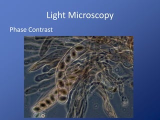 Light Microscopy 
Phase Contrast 
 