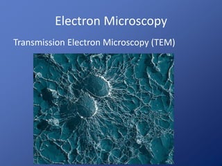 Electron Microscopy 
Transmission Electron Microscopy (TEM) 
 