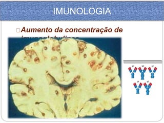 IMUNOLOGIA 
Aumento da concentração de 
imunoglobulinas 
 