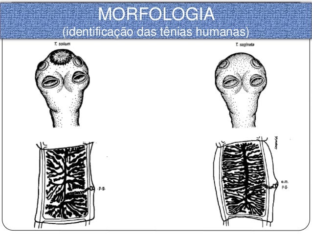Resultado de imagem para Morfologia de tênias