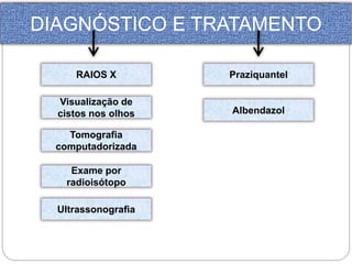 DIAGNÓSTICO E TRATAMENTO 
RAIOS X 
Visualização de 
cistos nos olhos 
Tomografia 
computadorizada 
Exame por 
radioisótopo 
Ultrassonografia 
Praziquantel 
Albendazol 
 
