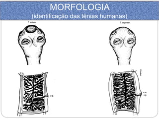 MORFOLOGIA 
(identificação das tênias humanas) 
 