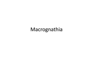 Macrognathia
 