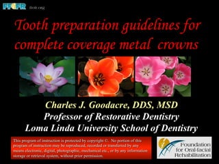 Charles J. Goodacre, DDS, MSD
Professor of Restorative Dentistry
Loma Linda University School of Dentistry
This program of instruction is protected by copyright ©. No portion of this
program of instruction may be reproduced, recorded or transferred by any
means electronic, digital, photographic, mechanical etc., or by any information
storage or retrieval system, without prior permission.
Tooth preparation guidelines for
complete coverage metal crowns
 