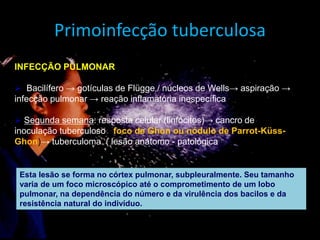 INFECÇÃO PULMONAR
 Bacilífero → gotículas de Flügge / núcleos de Wells→ aspiração →
infecção pulmonar → reação inflamatória inespecífica
 Segunda semana: resposta celular (linfócitos)→ cancro de
inoculação tuberculoso ( foco de Ghon ou nódulo de Parrot-Küss-
Ghon)→ tuberculoma ( lesão anátomo - patológica).
Esta lesão se forma no córtex pulmonar, subpleuralmente. Seu tamanho
varia de um foco microscópico até o comprometimento de um lobo
pulmonar, na dependência do número e da virulência dos bacilos e da
resistência natural do indivíduo.
Primoinfecção tuberculosa
 
