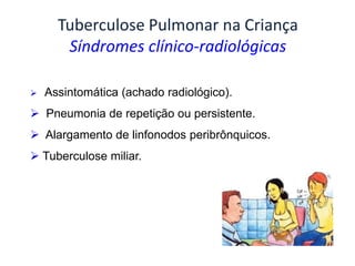 Tuberculose Pulmonar na Criança
Síndromes clínico-radiológicas
 Assintomática (achado radiológico).
 Pneumonia de repetição ou persistente.
 Alargamento de linfonodos peribrônquicos.
 Tuberculose miliar.
 