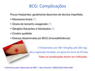 Pouco freqüentes; geralmente decorrem de técnica imperfeita.
 Abscessos locais (*)
 Úlcera de tamanho exagerado (*)
 Gânglios flutuantes e fistulizados (*)
 Cicatriz quelóide
 Doença disseminada por BCG (imunodeficiência)
(*)Tratamento com INH 10mg/Kg (até 300 mg),
até a regressão da lesão, em geral em torno de 45 dias.
Todas as complicações devem ser notificadas.
BCG: Complicações
III Diretrizes para Tuberculose da SBPT. J Bras Pneumol. 2009;35(10):1018-1048
 