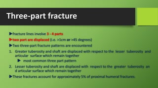 Three-part fracture
fracture lines involve 3 - 4 parts
two part are displaced (i.e. >1cm or >45 degrees)
Two three-part fracture patterns are encountered
1. Greater tuberosity and shaft are displaced with respect to the lesser tuberosity and
articular surface which remain together
 most common three part pattern
2. Lesser tuberosity and shaft are displaced with respect to the greater tuberosity an
d articular surface which remain together
These fractures account for approximately 5% of proximal humeral fractures.
 