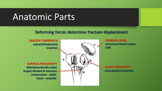 HUMERAL HEAD:
precarious blood supply
AVN
LESSER TUBEROSITY:
subscapularis insertion
GREATER TUBEROSITY:
supra/infraspinatus
insertion
SURGICAL NECK/SHAFT:
deltoid/pectoralis major
largely dictates fx behavior
compression: stable
shear: unstable
Anatomic Parts
Deforming forces determine fracture displacement
 