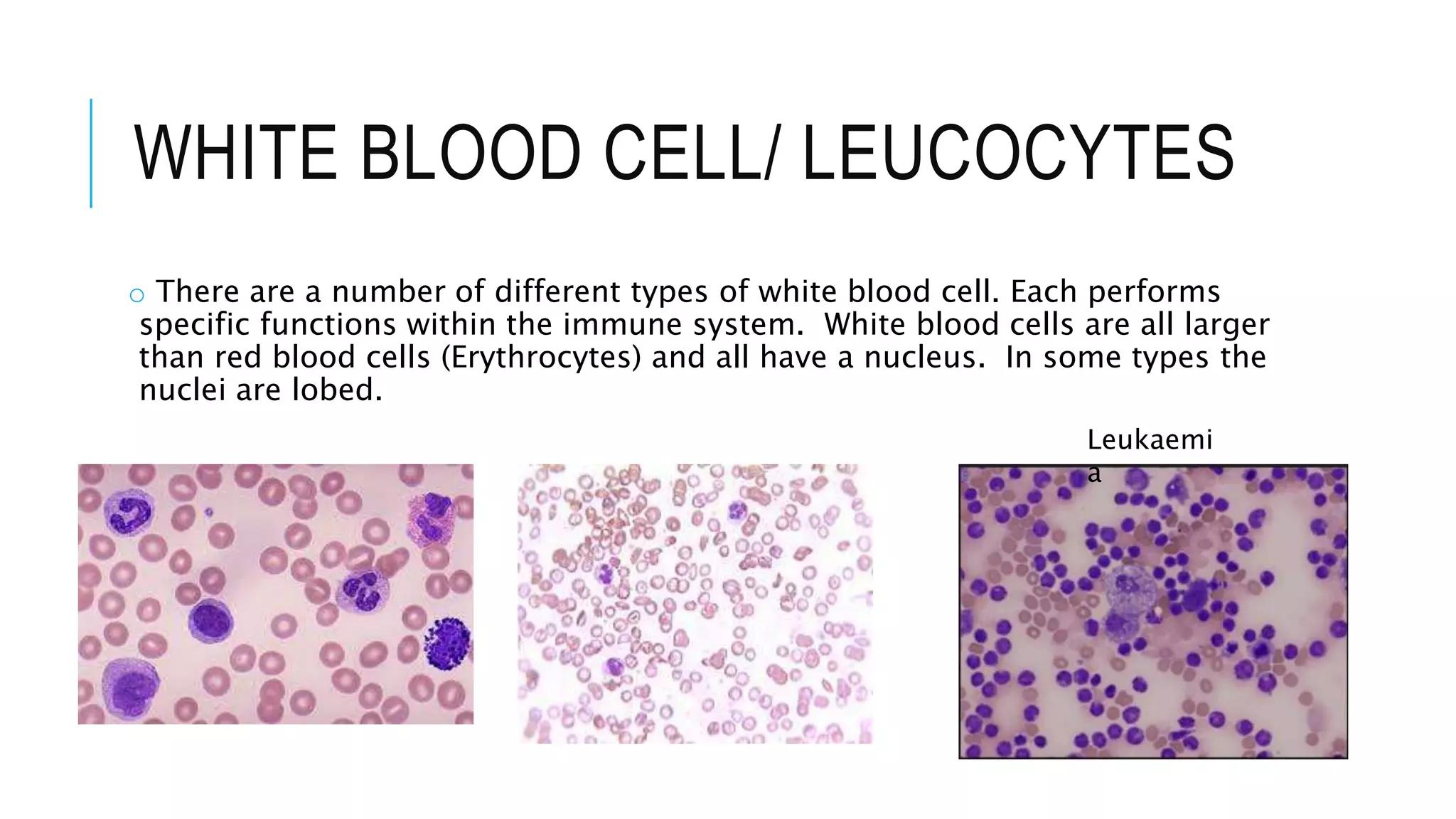 WHITE BLOOD CELL/ LEUCOCYTES
o There are a number of different types of white blood cell. Each performs
specific functions within the immune system. White blood cells are all larger
than red blood cells (Erythrocytes) and all have a nucleus. In some types the
nuclei are lobed.
Leukaemi
a
 