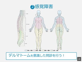 2
8
 　  感覚障害2
デルマトームを意識識した問診を⾏行行う！
 