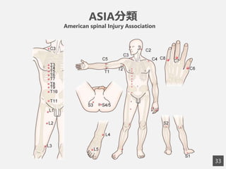 3
3
ASIA分類
American spinal Injury Association
 