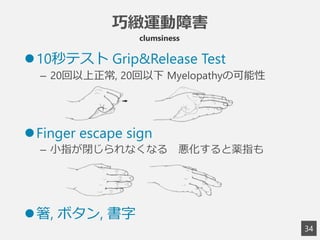 3
4
l 10秒テスト  Grip&Release Test
–  20回以上正常, 20回以下  Myelopathyの可能性
l Finger escape sign
–  ⼩小指が閉じられなくなる 　悪化すると薬指も
l 箸,  ボタン,  書字
巧緻運動障害
clumsiness
 