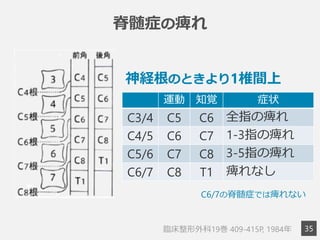 3
5
脊髄症の痺れ
神経根のときより1椎間上
運動 知覚 症状
C3/4 C5 C6 全指の痺れ
C4/5 C6 C7 1-3指の痺れ
C5/6 C7 C8 3-5指の痺れ
C6/7 C8 T1 痺れなし
臨臨床整形外科19巻  409-415P, 1984年年
  C6/7の脊髄症では痺れない
 