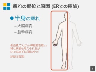 6
l 半⾝身の痺れ
– ⼤大脳病変
– 脳幹病変
痺れの部位と原因  (ERでの極論論)
低⾎血糖,てんかん,神経変性症など
稀な病態も考えられるが,
ERではまずは｢頭の中｣!!
診断は容易易!
 