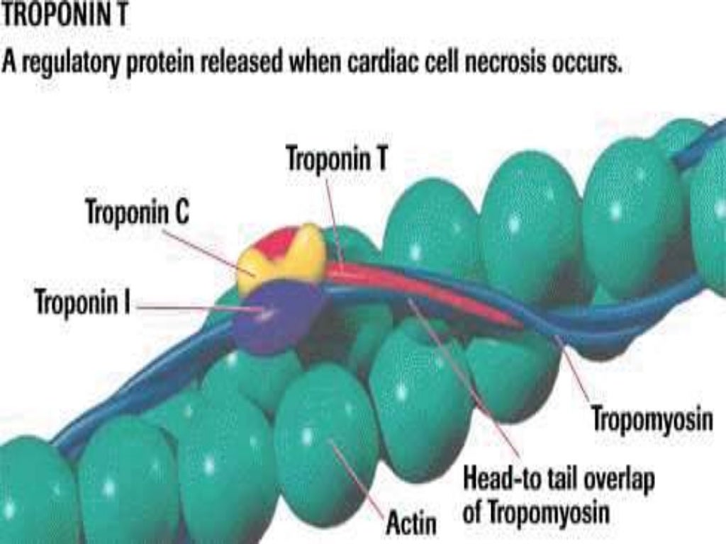 4.sakina cardiac enzymes