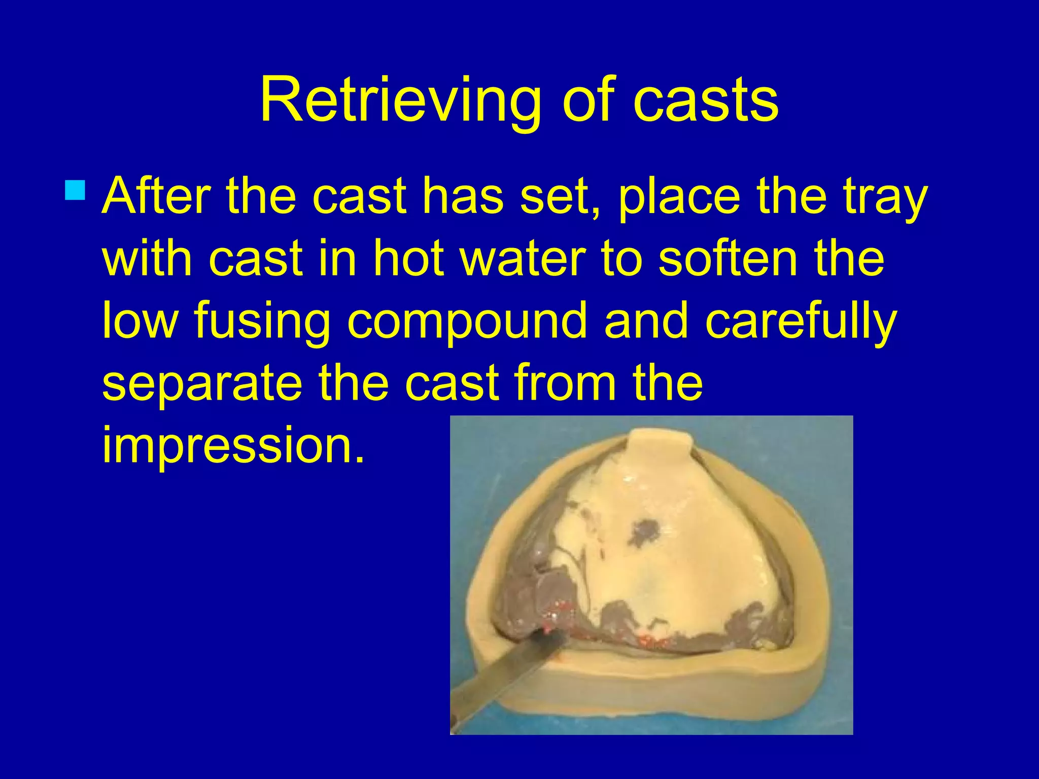 custom trays & master casts | PPT