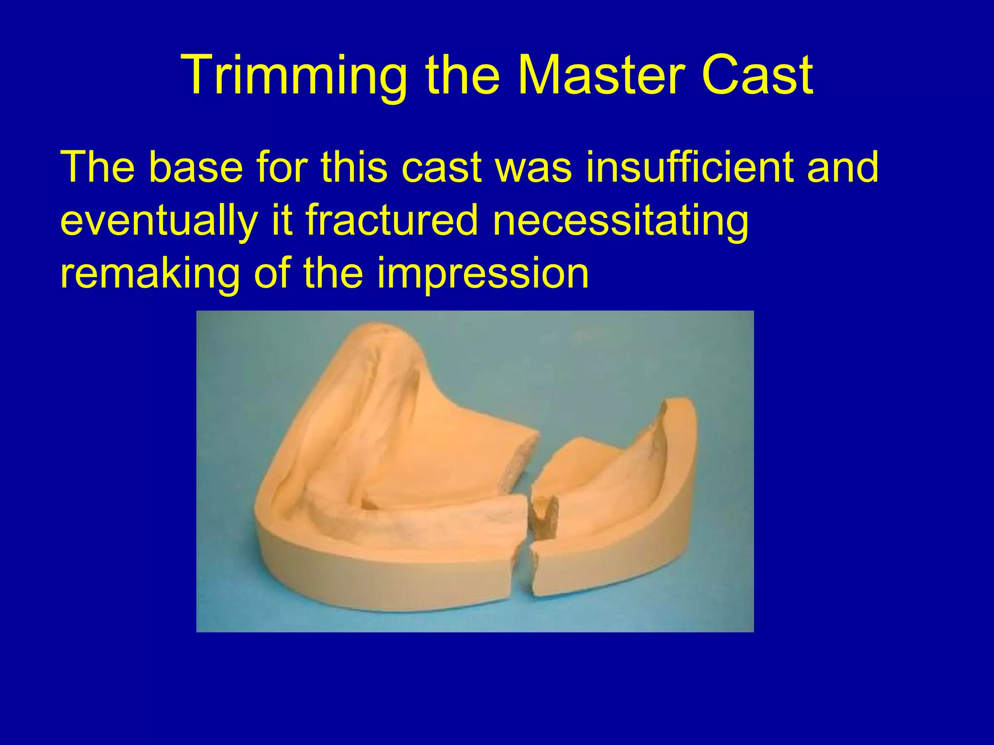 Master Cast Model custom trays & master casts | PPT