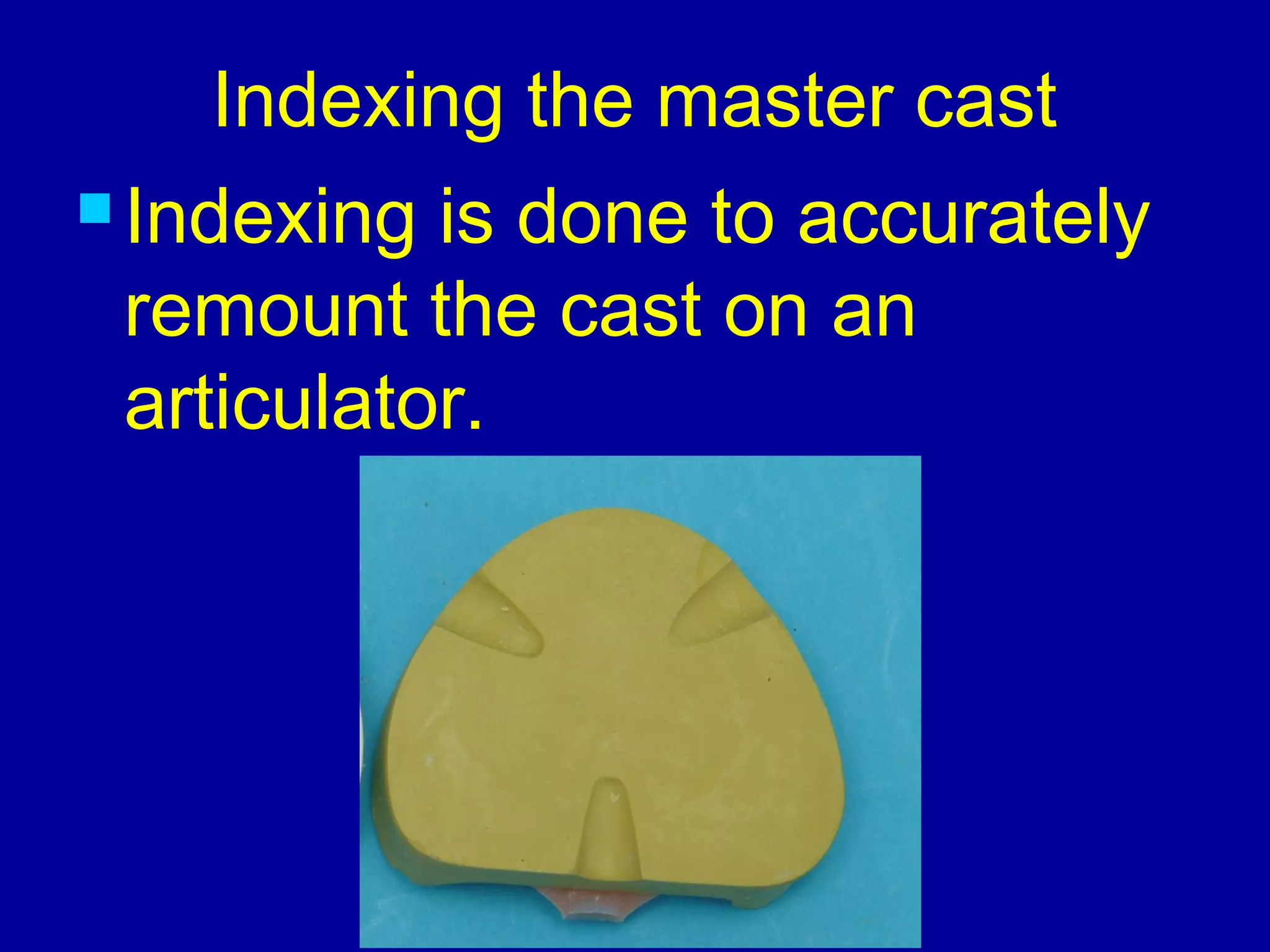 Master Cast Model custom trays & master casts | PPT