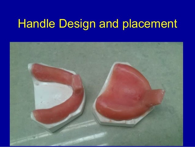 custom trays for dentures custom trays custom trays for dentures custom trays