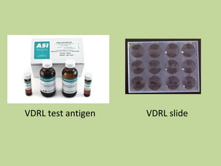 VDRL test antigen VDRL slide
 