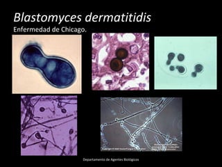 Blastomyces dermatitidis
Enfermedad de Chicago.
Departamento de Agentes Biológicos
 