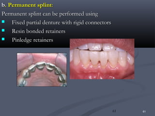 Pin Ledge 4.n periodontal aspects | PPT