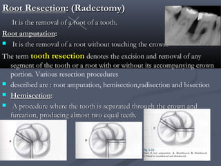 4.n periodontal aspects | PPT