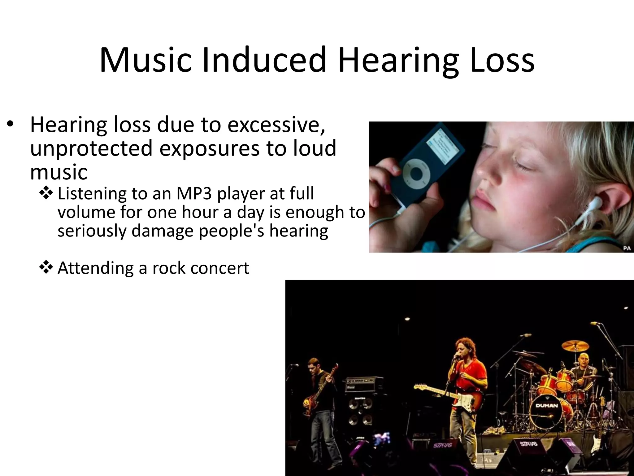 Music Induced Hearing Loss
• Hearing loss due to excessive,
unprotected exposures to loud
music
Listening to an MP3 player at full
volume for one hour a day is enough to
seriously damage people's hearing
Attending a rock concert
 