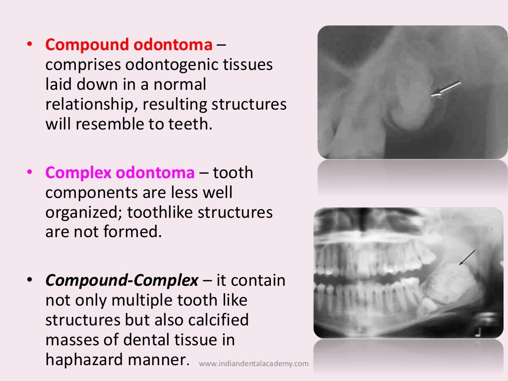 mixed radiolucent and radiopaque lesions / oral surgery courses