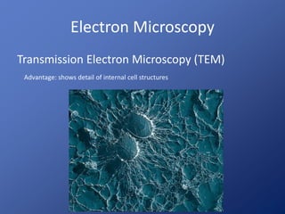 Electron Microscopy
Transmission Electron Microscopy (TEM)
Advantage: shows detail of internal cell structures
 