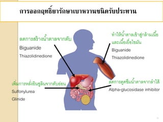 การออกฤทธิ์ยารักษาเบาหวานชนิดรับประทาน
ลดการสร้างน้าตาลจากตับ
Biguanide
Thiazolidinedione
เพิ่มการหลั่งอินซูลินจากตับอ่อน
Sulfonylurea
Glinide
ทาให้น้าตาลเข้าสู่กล้ามเนื้อ
และเนื้อเยื่อไขมัน
Biguanide
Thiazolidinedione
ลดการดูดซึมน้าตาลจากลาใส้
Alpha-glucosidase inhibitor
26
 
