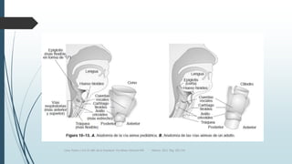 Luna, Pastor y Col. EL ABC de la Anestesia. Vía Aérea. Editorial Alfil. México. 2011. Pág. 183-214.
 