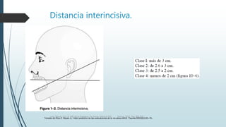 Distancia interincisiva.
Tomado de Ríos E, Reyes JL: Valor predictivo de las evaluaciones de la vía aérea difícil. Trauma 2005;8(3):63–70.Luna, Pastor y Col. EL ABC de la Anestesia. Vía Aérea. Editorial Alfil. México. 2011. Pág. 183-214.
 