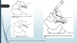 Tomado de Ríos E, Reyes JL: Valor predictivo de las evaluaciones de la vía aérea difícil. Trauma 2005;8(3):63–70.
 