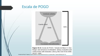Escala de POGO
Tomado de Ríos E, Reyes JL: Valor predictivo de las evaluaciones de la vía aérea difícil. Trauma 2005;8(3):63–70.
 