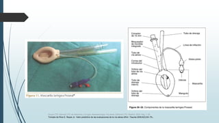 Grupo CTO. Manual CTO de Medicina y Cirugía. Anestesiología. Vía aérea. Editorial CTO. Madrid. 2014. Pág. 7-16.
Tomado de Ríos E, Reyes JL: Valor predictivo de las evaluaciones de la vía aérea difícil. Trauma 2005;8(3):63–70.
 