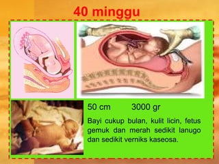 40 minggu
50 cm 3000 gr
Bayi cukup bulan, kulit licin, fetus
gemuk dan merah sedikit lanugo
dan sedikit verniks kaseosa.
 