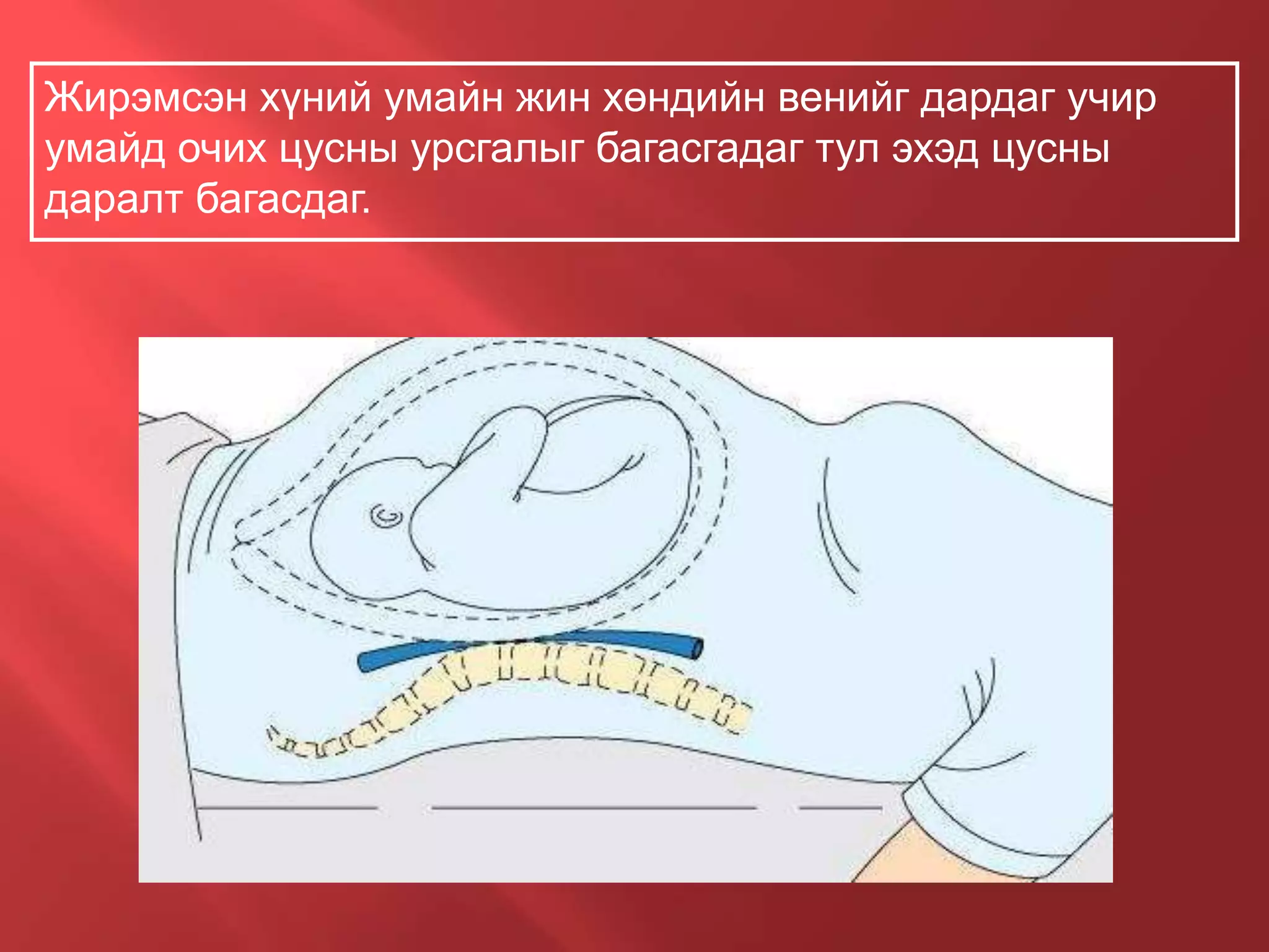 4. Жирэмсэн үед гарах физиологийн өөрчлөлтүүд | PPT