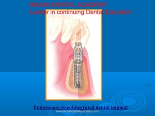 Endosseous osseointegrated dental implant
INDIAN DENTAL ACADEMY
Leader in continuing Dental Education
www.indiandentalacademy.comwww.indiandentalacademy.com
 