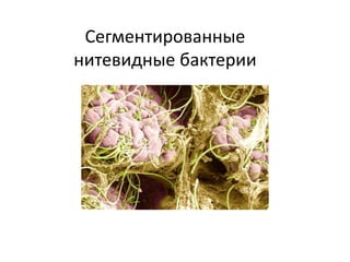 Сегментированные
нитевидные бактерии
 
