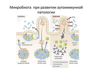Микробиота при развитии аутоиммунной
патологии
Сегментированные
нитевидные
бактерии
 
