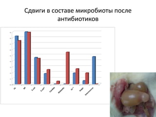 Сдвиги в составе микробиоты после
антибиотиков
0
1
2
3
4
5
6
7
8
9
Lb.
Bif
E.coli
E.coli*
Candida
Klebsiella
Gr-*
Staph.
Enterococcus
 