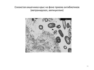 Слизистая кишечника крыс на фоне приема антибиотиков
(метранидазол, ампициллин)
33
 