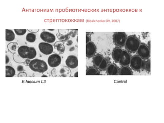 Антагонизм пробиотических энтерококков к
стрептококкам (Ribalchenko OV, 2007)
E.faecium L3 Control
 