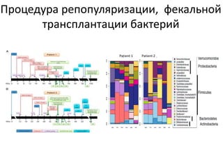 Процедура репопуляризации, фекальной
трансплантации бактерий
Patient 1 Patient 2
 