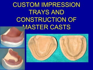 CUSTOM IMPRESSION
TRAYS AND
CONSTRUCTION OF
MASTER CASTS
 