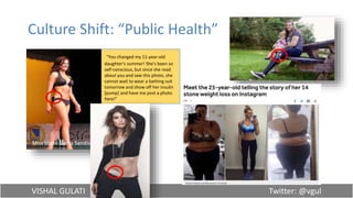 VISHAL GULATI Twitter: @vgul
Culture Shift: “Public Health”
"You changed my 11-year-old
daughter's summer! She's been so
self-conscious, but since she read
about you and saw this photo, she
cannot wait to wear a bathing suit
tomorrow and show off her insulin
[pump] and have me post a photo
here!"
Miss Idaho Sierra Sandison
 