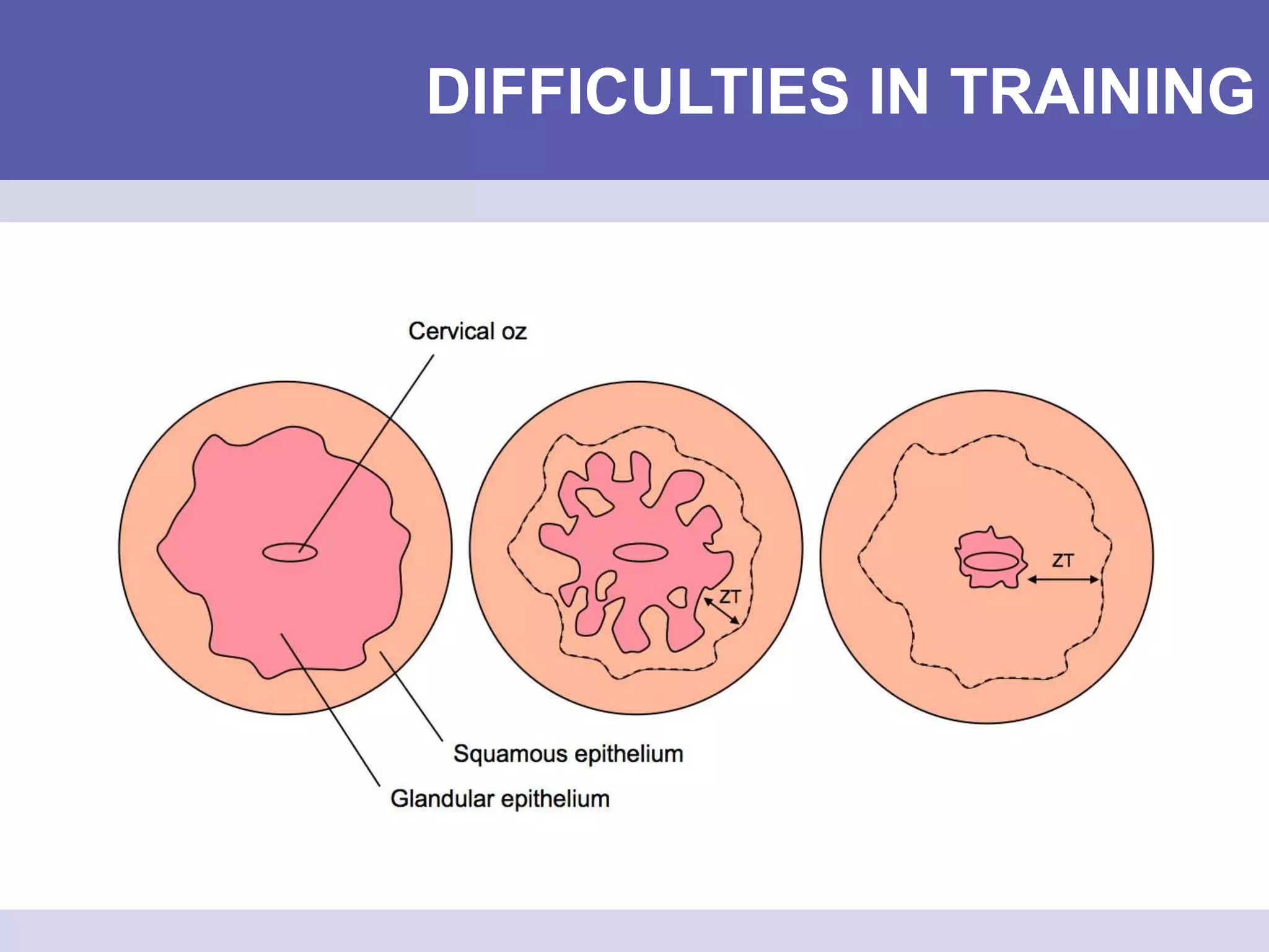 DIFFICULTIES IN TRAINING
 