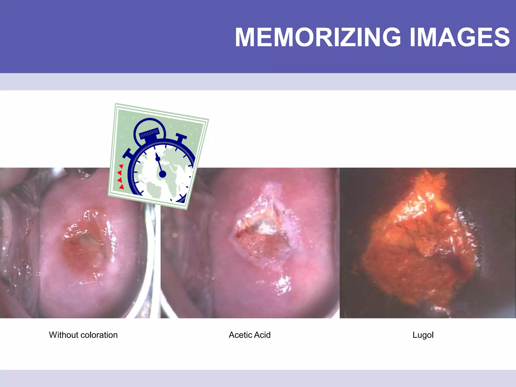 MEMORIZING IMAGES
Without coloration Acetic Acid Lugol
 